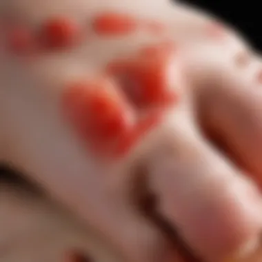 Symptoms of Red Spots on the Foot Close-up view of skin symptoms indicating redness and irritation
