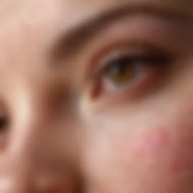 Close-up of skin showing eczema affected area