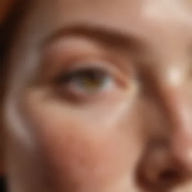 Close-up of sun-induced freckles on fair skin