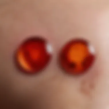 Illustration of common skin conditions causing red spots