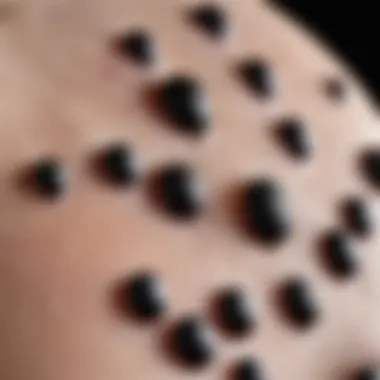 Close-up of blackheads on skin