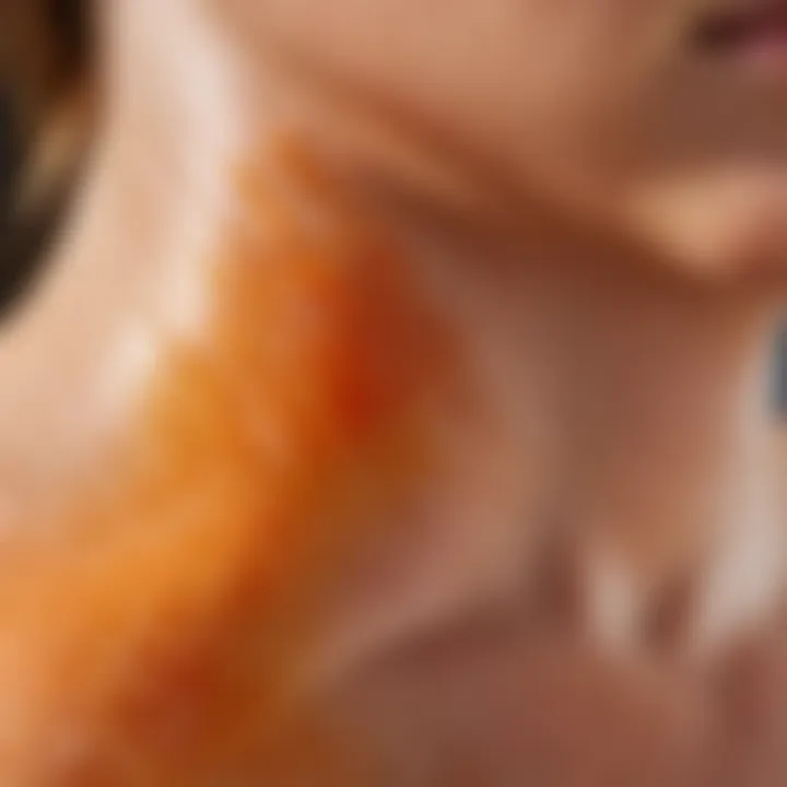 Close-up view of sunburned skin showing peeling