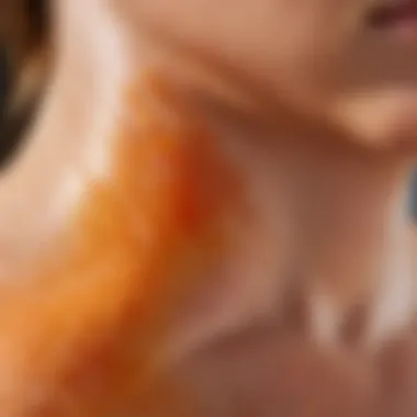 Sunburn Peeling Close-Up Close-up view of sunburned skin showing peeling