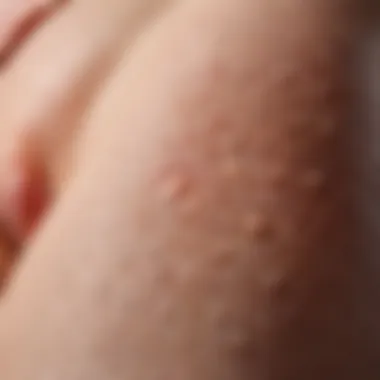 Close-up of skin texture highlighting acne