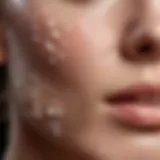 Close-up of dry facial skin with visible flakes